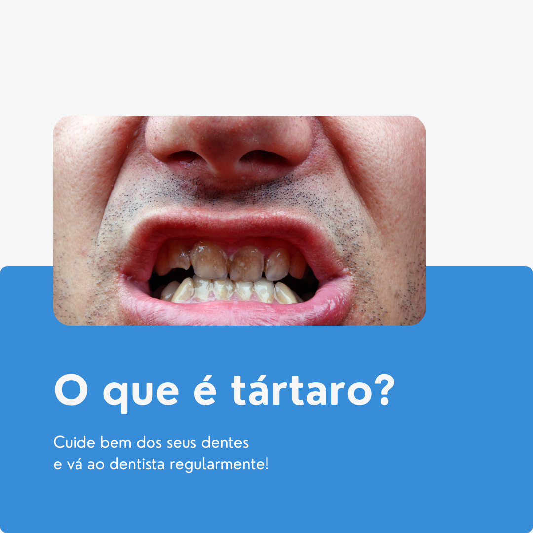 Marketing Criativo