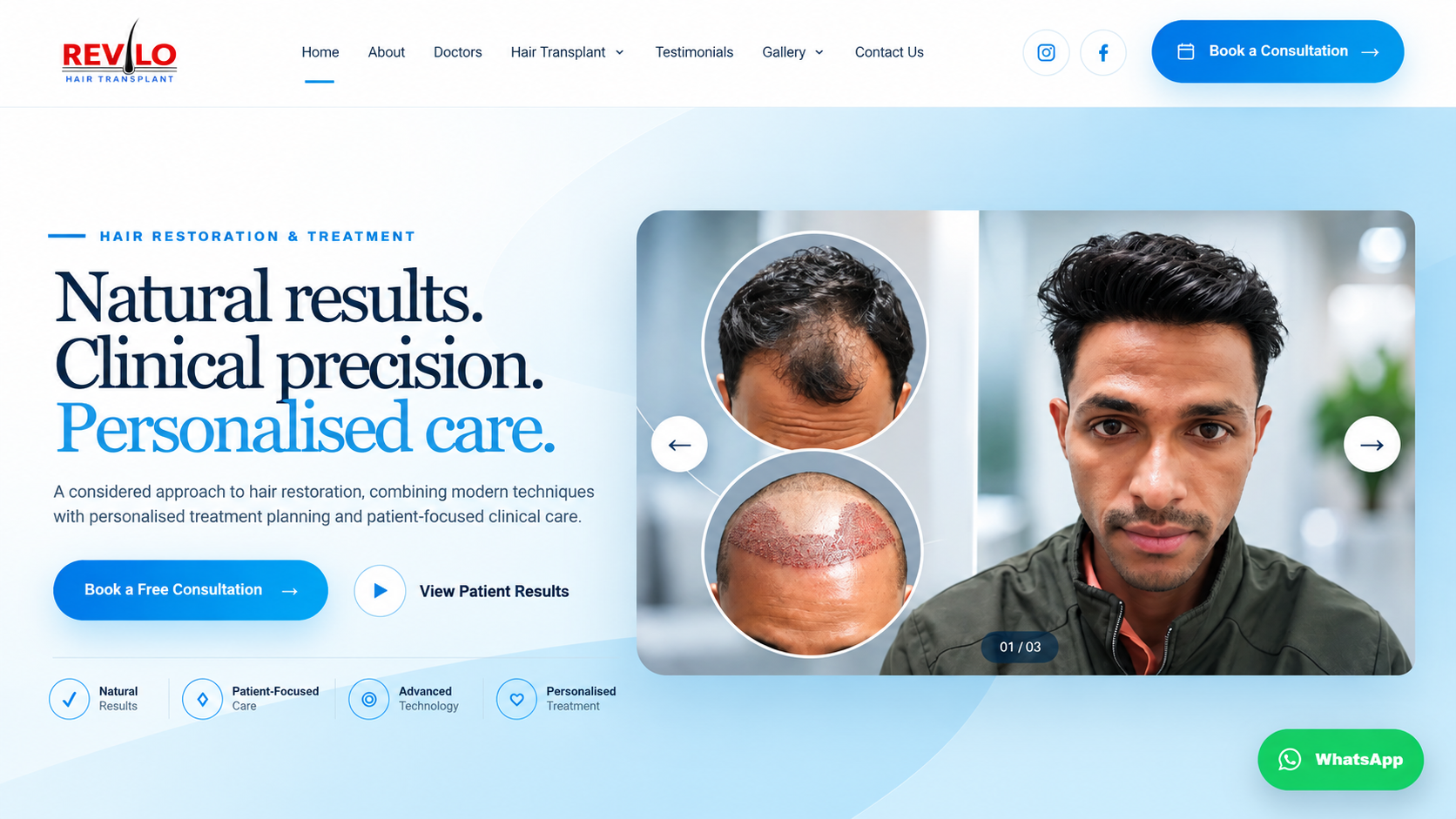 Revilo Hair Transplant